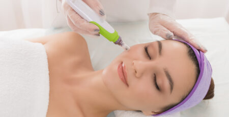 needling e microneedling