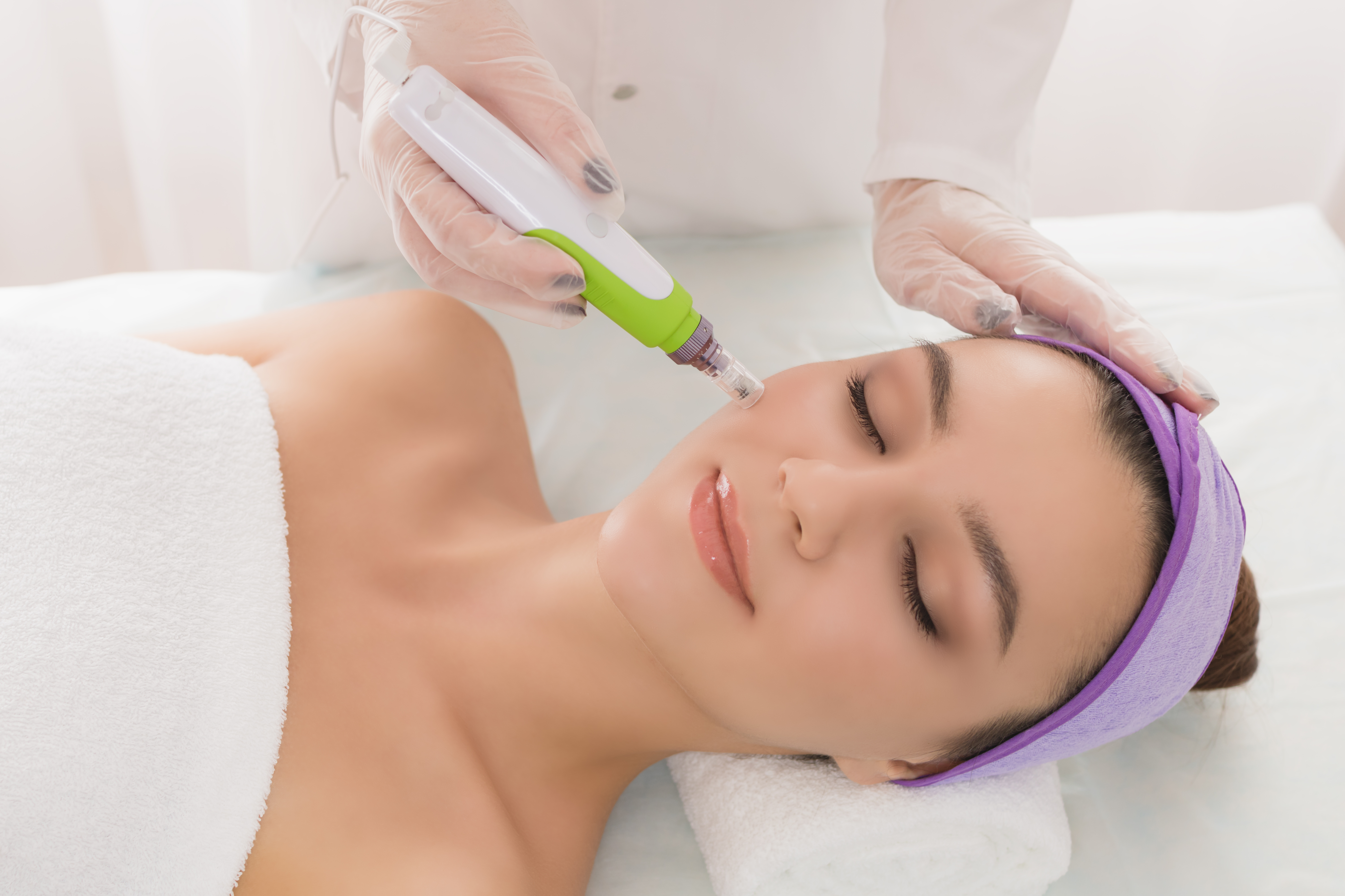 needling e microneedling