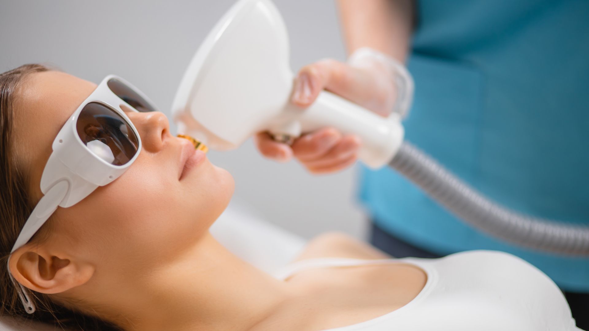 epilazione laser viso