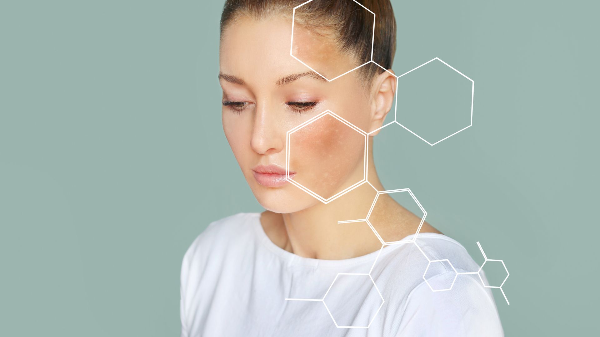 micosi cutanee - dott.pozzi - bergamo