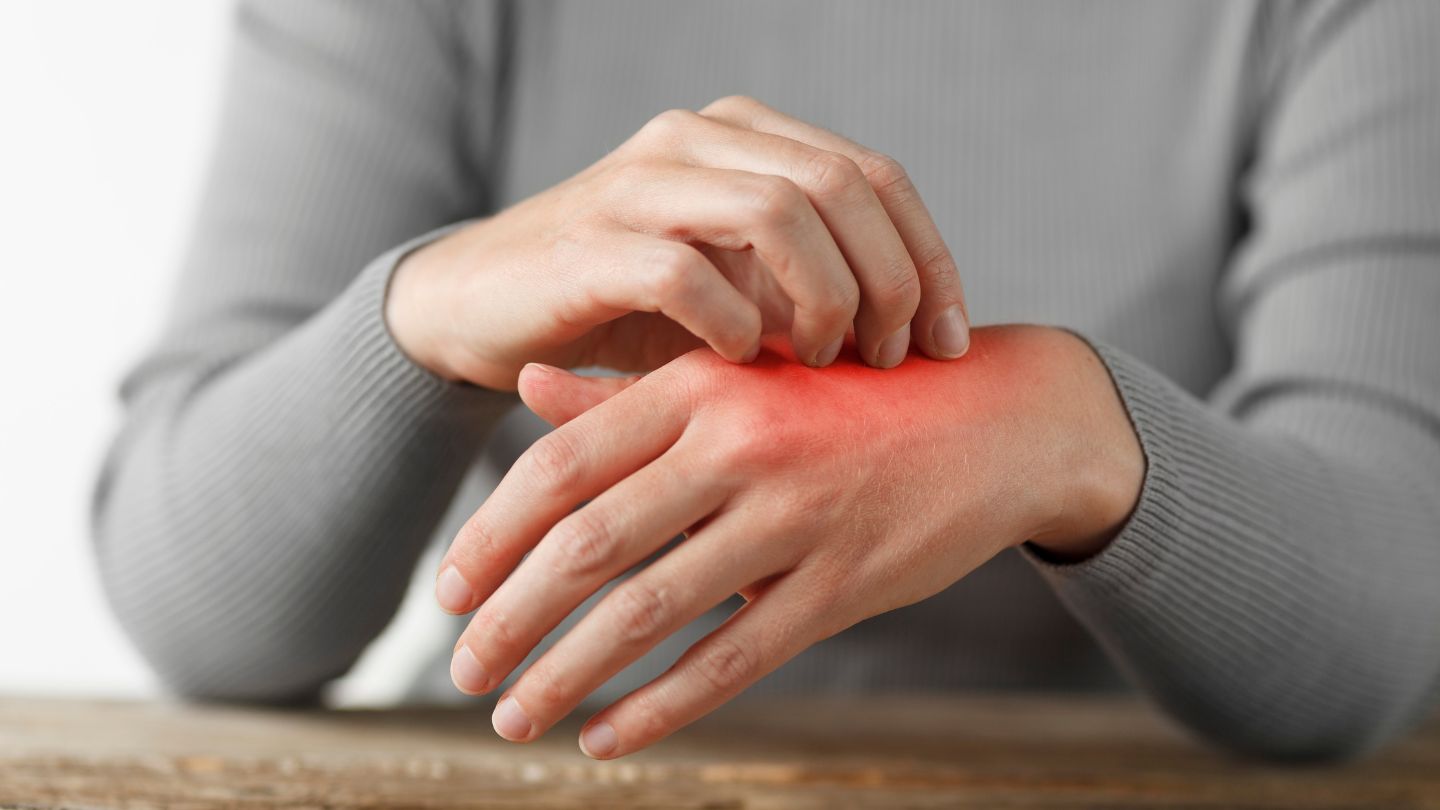 La psoriasi - malattia- pelle - dermatologa pozzi bergamo (1)